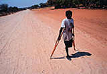 This young boy lost his leg through an exploding mine